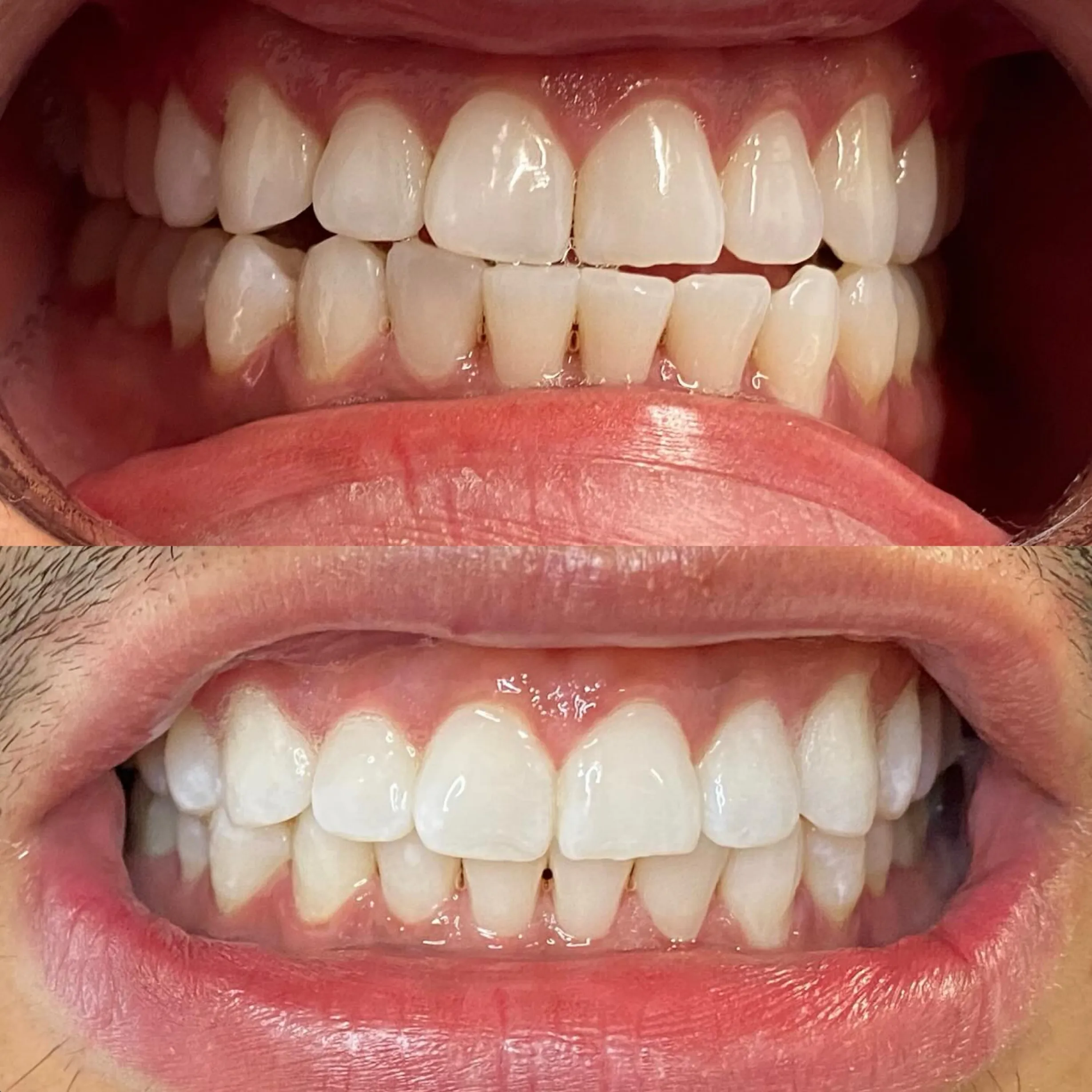 client demand for whitening