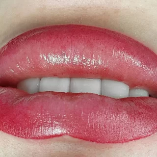 Why Has my Lip Tattoo Disappeared