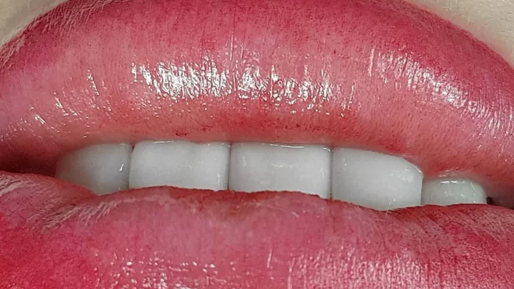 Why Has my Lip Tattoo Disappeared