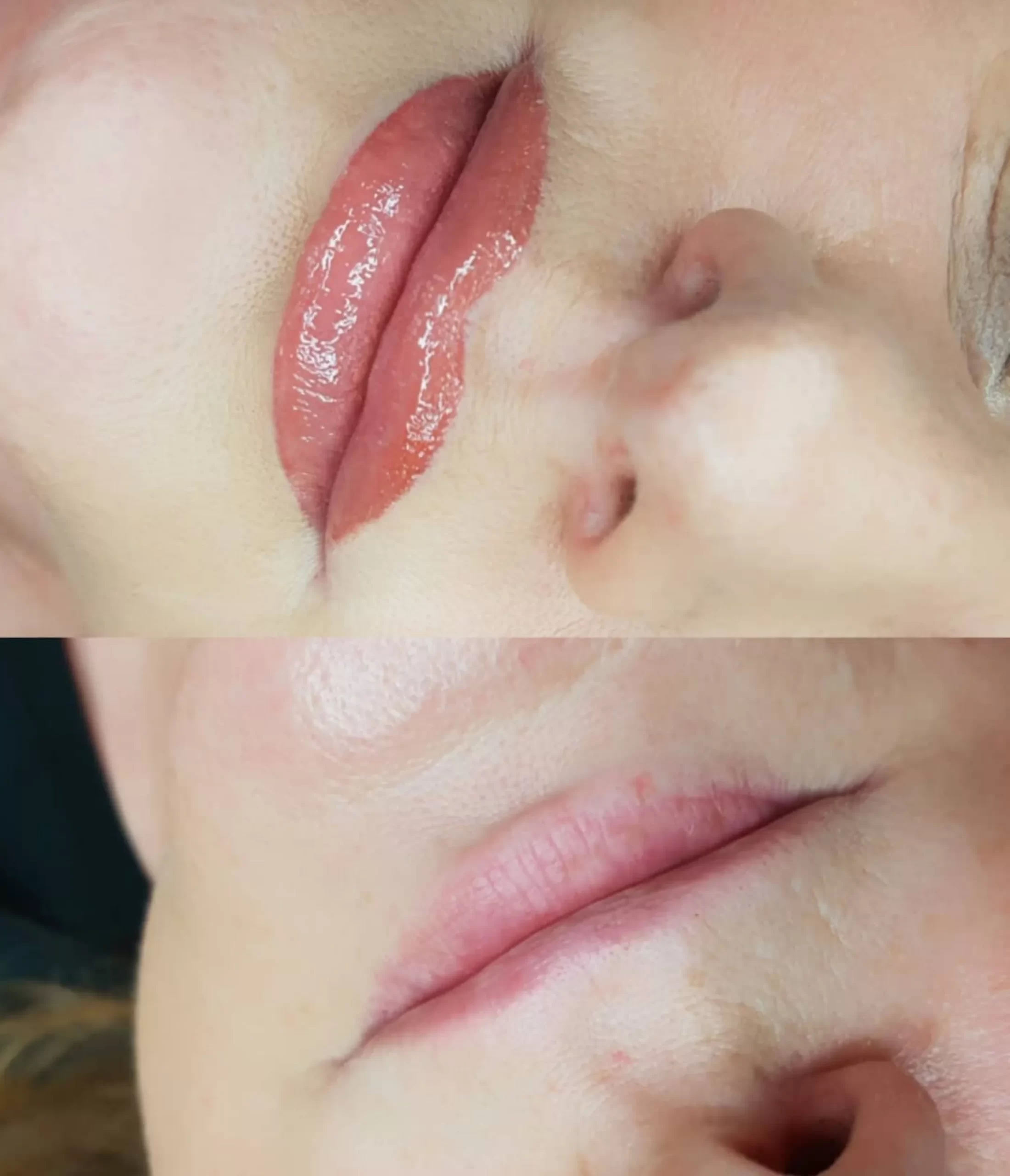 lip tattoo pigment loss causes