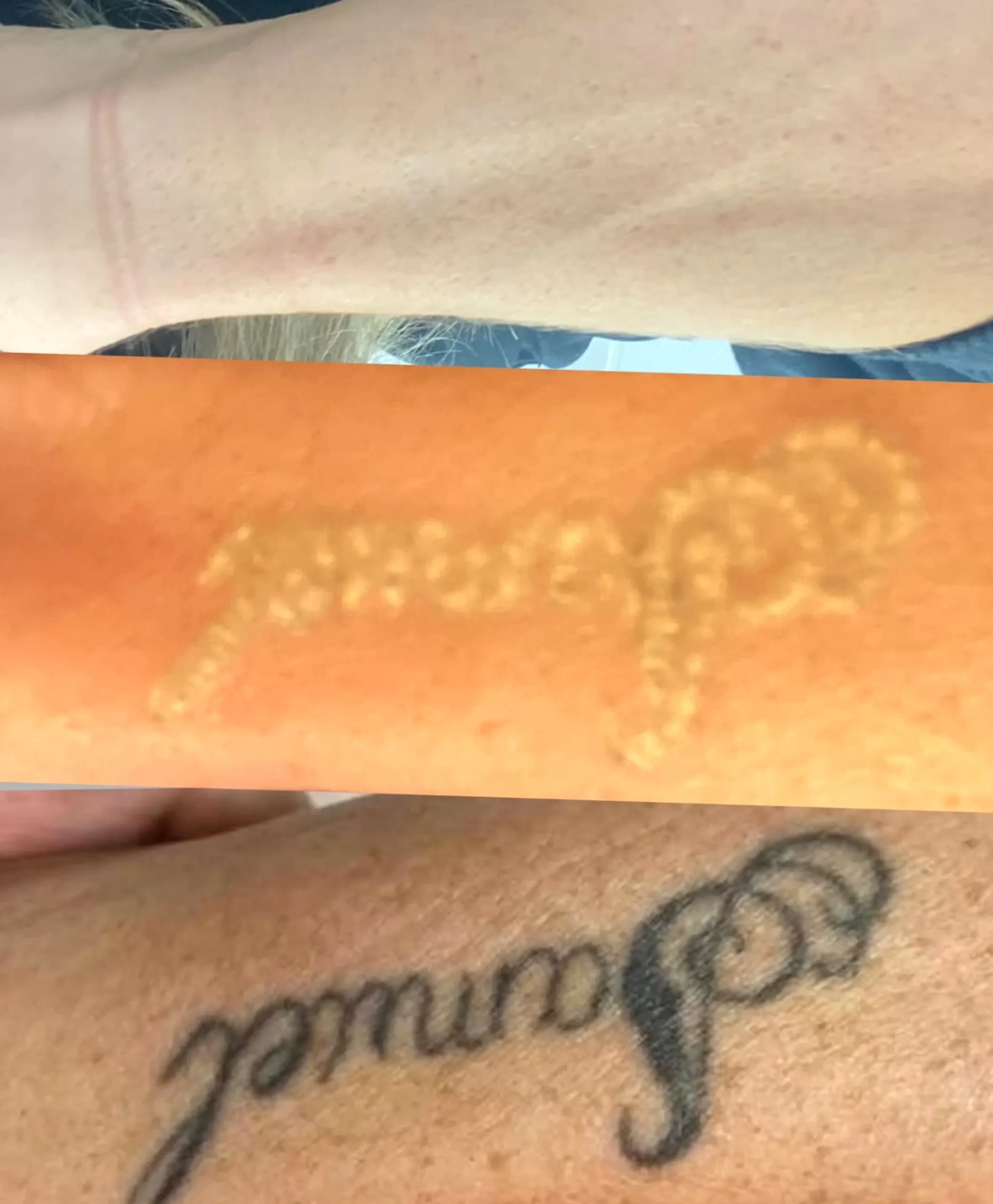legit tattoo removal courses